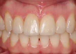 Kako odabrati najboljeg ortodonta?
